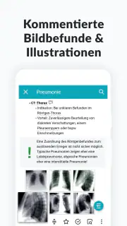 AMBOSS Wissen für Mediziner screenshot 7