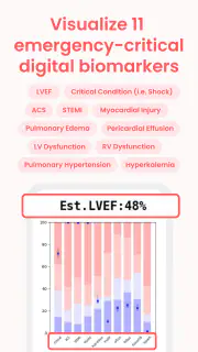 ECG Buddy | ECG Analysis AI screenshot 4