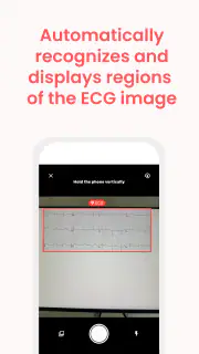 ECG Buddy | ECG Analysis AI screenshot 5