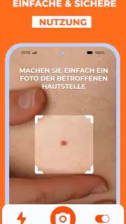 Haut Scanner: KI hautarzt app screenshot 3