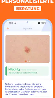 Haut Scanner: KI hautarzt app screenshot 5
