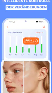 Haut Scanner: KI hautarzt app screenshot 6