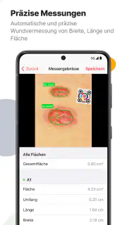 imitoWound - Wunddokumentation screenshot 3