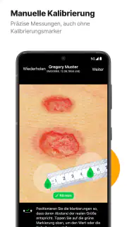imitoWound - Wunddokumentation screenshot 6
