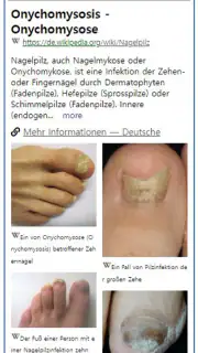 Model Dermatol – Hautkrankheit screenshot 4
