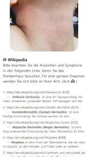 Model Dermatol – Hautkrankheit screenshot 5