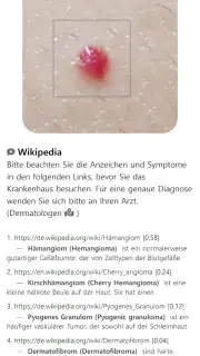 Model Dermatol – Hautkrankheit screenshot 7