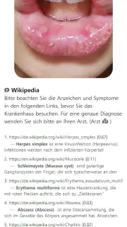 Model Dermatol – Hautkrankheit screenshot 8