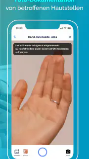 Neurodermitis App Nia screenshot 2