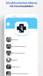 OrthoRad screenshot 3