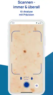 SkinScreener screenshot 4