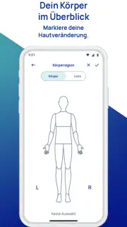 SkinScreener screenshot 6