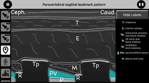 AnSo Anaesthesia Sonoanatomy screenshot 8