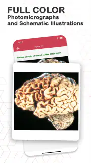 Board Review Series-Pathology screenshot 6