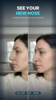 Nose Job - Plastic Surgery AI screenshot 1