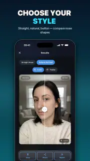 Nose Job - Plastic Surgery AI screenshot 5