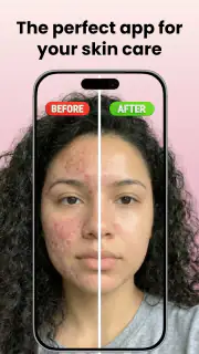 Skin Care Scanner: GlowUp screenshot 1