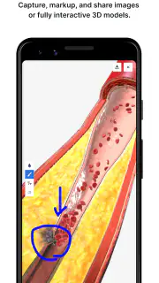 BioDigital Human - 3D Anatomy screenshot 5