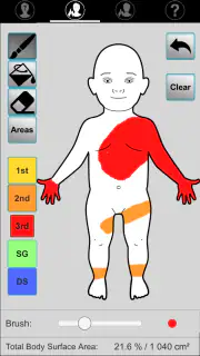 E-burn Premium screenshot 5