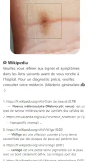 Model Derm – Maladie de peau screenshot 1