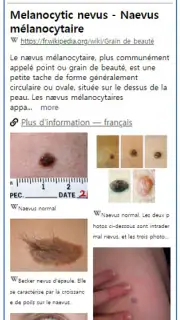 Model Derm – Maladie de peau screenshot 2