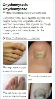 Model Derm – Maladie de peau screenshot 5