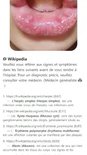 Model Derm – Maladie de peau screenshot 8