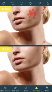 Photo Retouch-Object Removal screenshot 2