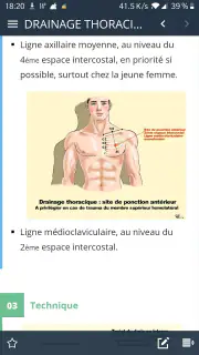 SMUR BMPM screenshot 6
