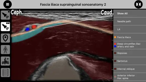 AnSo Anaesthesia Sonoanatomy screenshot 4