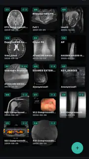 DICOM Viewer screenshot 3