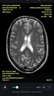 DICOM Viewer screenshot 7