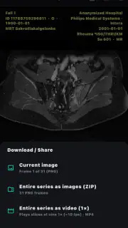 DICOM Viewer screenshot 8