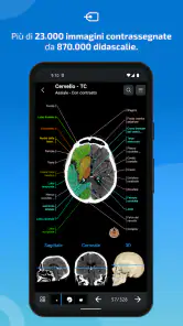 IMAIOS e-Anatomy screenshot 2