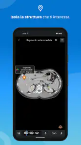 IMAIOS e-Anatomy screenshot 4