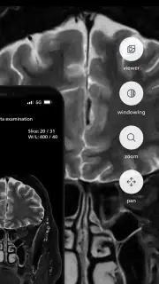 Philips MR Imaging screenshot 6