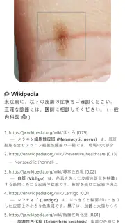 Model Dermatol – 皮膚疾患 screenshot 1