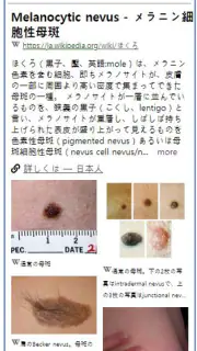 Model Dermatol – 皮膚疾患 screenshot 2