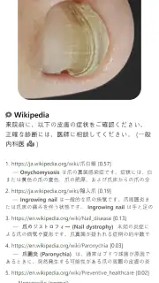 Model Dermatol – 皮膚疾患 screenshot 3