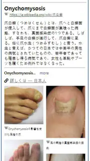 Model Dermatol – 皮膚疾患 screenshot 4