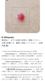 Model Dermatol – 皮膚疾患 screenshot 7