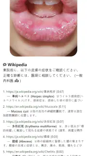 Model Dermatol – 皮膚疾患 screenshot 8