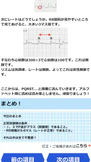 みんなde心電図 screenshot 8