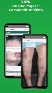 5-Minute Clinical Consult screenshot 4