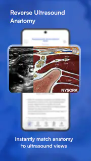NYSORA Nerve Blocks screenshot 5