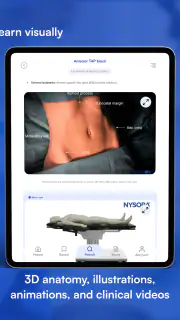 NYSORA Nerve Blocks screenshot 8