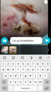 Ons Wondzorg screenshot 7