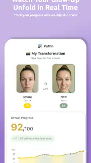 Puffin: Acne Tracker screenshot 5