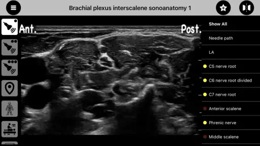 AnSo Anaesthesia Sonoanatomy screenshot 3