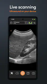 App de Ultrassom Clarius screenshot 2